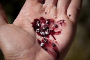 Cochineal Insect Whey They Are Dead